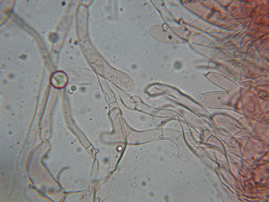 O l''uno... o l''atro???